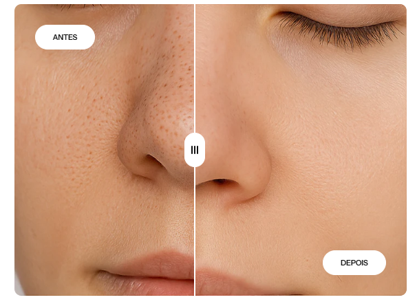 LANBENA Original Máscara Removedora de Cravos e Acnes 2% BHA