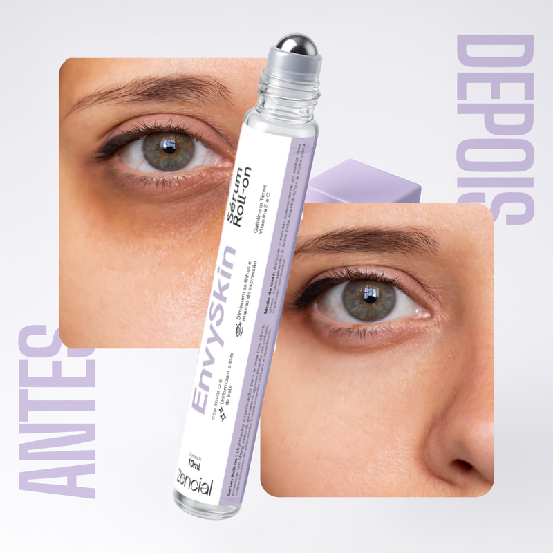Zencial Envy Skin™ - Sérum Clareador de Olheiras Roll-On  - Com Niacinamida 5% e Vitamina C - Efeito Lifting Instantâneo