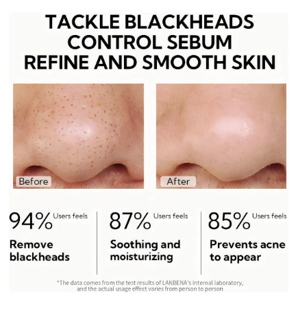 LANBENA Original Máscara Removedora de Cravos e Acnes 2% BHA