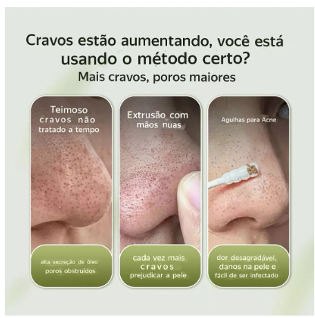 LANBENA Original Máscara Removedora de Cravos e Acnes 2% BHA