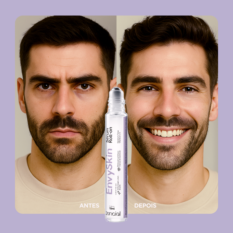 Zencial Envy Skin™ - Sérum Clareador de Olheiras Roll-On  - Com Niacinamida 5% e Vitamina C - Efeito Lifting Instantâneo