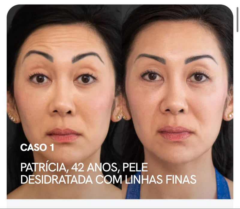 Eye Skin™ - Sérum Clareador de Olheiras Roll-On  - Com Niacinamida 5% e Vitamina C - Efeito Lifting Instantâneo