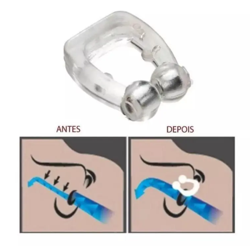 Clip Dilatador Nasal Aparelho Anti Ronco Sleep Quiet